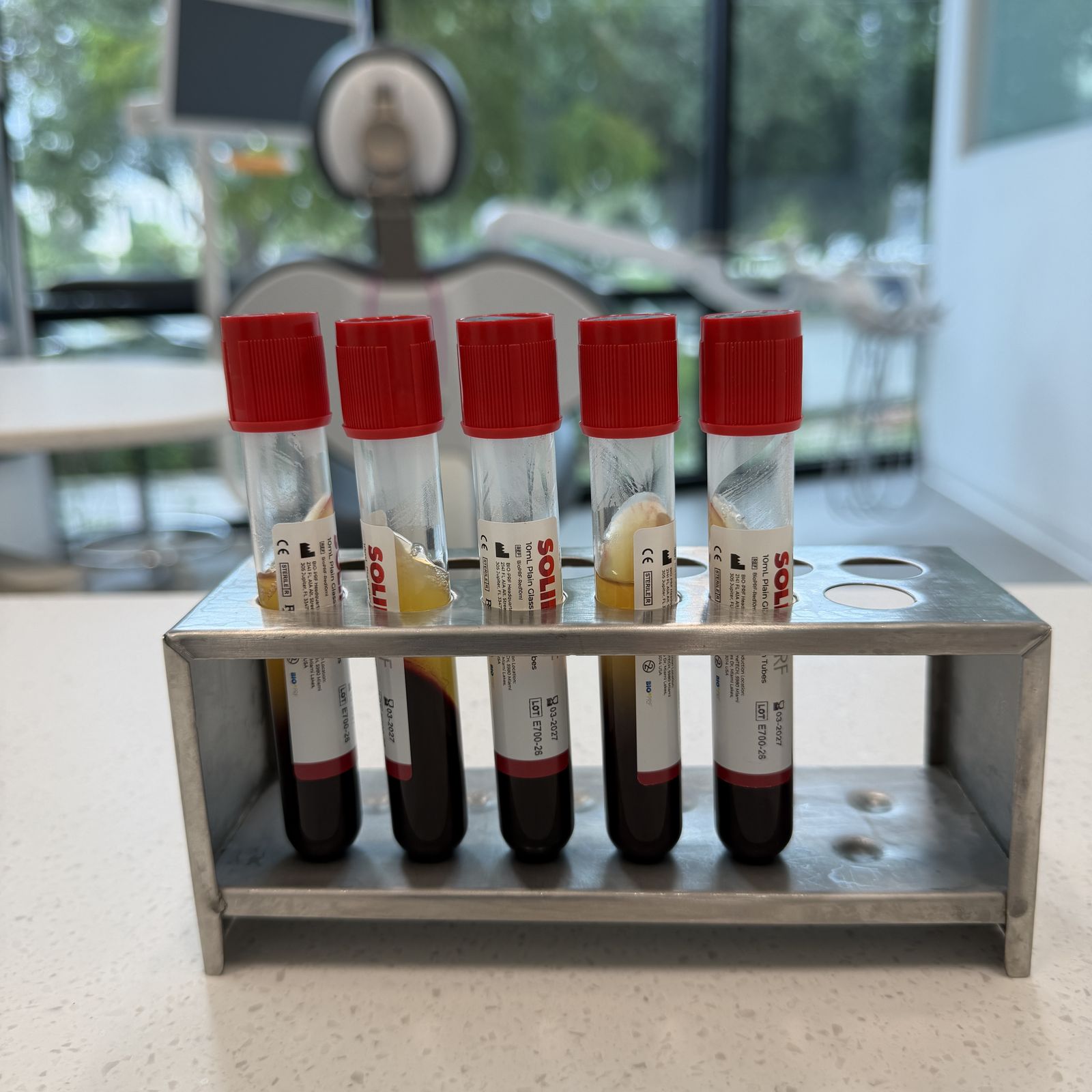 Blood collection tubes in a rack for LPRF preparation